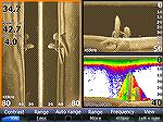 This is a screen shot of half-demolished railroad bridge pilings in a Montana lake. The left screen window shows them picked up by both the left and right side beams. The top right window shows the ve